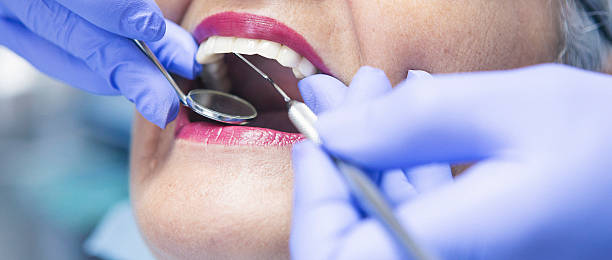 Best Urgent Dental Care for Toothache in Rochelle, GA